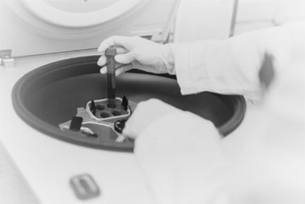 Exosomes